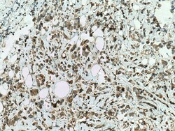 STK32A Mouse Monoclonal Antibody, Proteintech Unconjugated; 150 &mu;L:Antibodies,