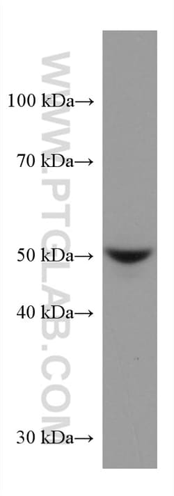 STK32A Mouse Monoclonal Antibody, Proteintech Unconjugated; 150 &mu;L:Antibodies,