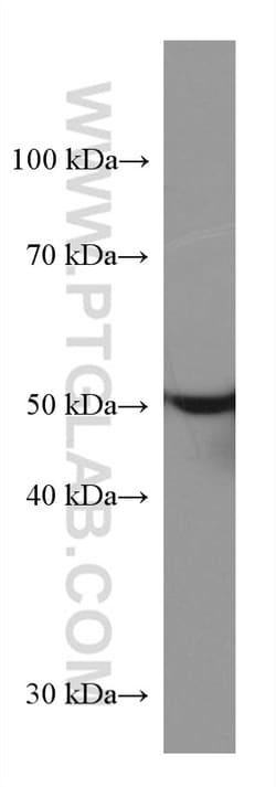 STK32A Mouse Monoclonal Antibody, Proteintech Unconjugated; 150 &mu;L:Antibodies,