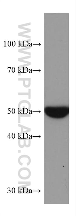 STK32A Mouse Monoclonal Antibody, Proteintech Unconjugated; 150 &mu;L:Antibodies,