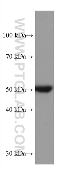 STK32A Mouse Monoclonal Antibody, Proteintech Unconjugated; 150 &mu;L:Antibodies,