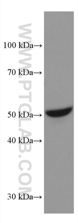 STK32A Mouse Monoclonal Antibody, Proteintech Unconjugated; 150 &mu;L:Antibodies,