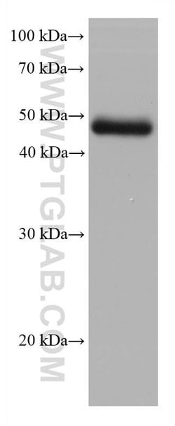 STRA8 Mouse anti-Human, Rabbit, Mouse, Clone: 1D7E3, Proteintech 20 &mu;L;