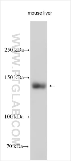 SULF2 Rabbit Polyclonal Antibody, Proteintech Unconjugated; 20 &mu;L:Antibodies,
