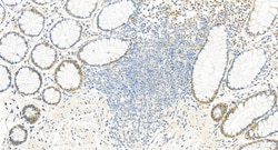 SUPT16H Mouse Monoclonal Antibody, Proteintech Unconjugated; 20 &mu;L:Antibodies,