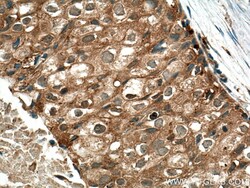 SURF4 Rabbit Polyclonal Antibody, Proteintech Unconjugated; 20 &mu;L:Antibodies,