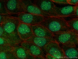 SYNCRIP Rabbit Polyclonal Antibody, Proteintech:Antibodies:Primary Antibodies