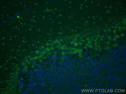 SYT2 Rabbit Polyclonal Antibody, Proteintech Unconjugated; 20 &mu;L:Antibodies,