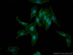 CoraLite Plus 488-conjugated Septin 2 Rabbit Polyclonal Antibody, Proteintech:Antibodies:Primary