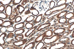 Serpina3g Rabbit Polyclonal Antibody, Proteintech:Antibodies:Primary Antibodies