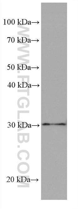 Stomatin Mouse Monoclonal Antibody, Proteintech:Antistoffer:Primære antistoffer