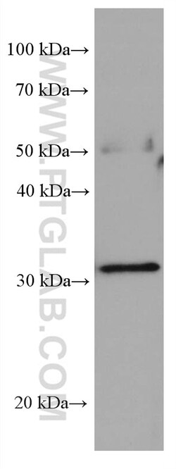 Stomatin Mouse Monoclonal Antibody, Proteintech