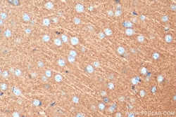 SYNGR1 Rabbit Polyclonal Antibody, Proteintech 150 &mu;L | Buy Online | Proteintech | Fisher Scientific