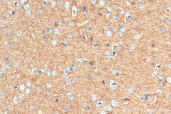 SYNGR1 Rabbit Polyclonal Antibody, Proteintech 150 &mu;L | Buy Online | Proteintech | Fisher Scientific