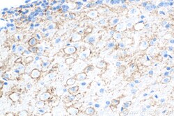 Synaptotagmin-1 Mouse Monoclonal Antibody, Proteintech 150 &mu;L | Buy Online | Proteintech | Fisher Scientific