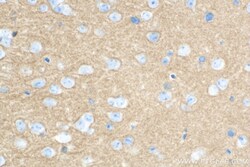 Synaptotagmin-1 Mouse Monoclonal Antibody, Proteintech 150 &mu;L | Buy Online | Proteintech | Fisher Scientific