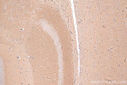 Synaptotagmin-3 Rabbit Polyclonal Antibody, Proteintech 150 &mu;L | Buy Online | Proteintech | Fisher Scientific