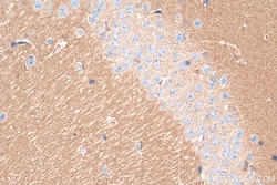 Synaptotagmin-3 Rabbit Polyclonal Antibody, Proteintech 150 &mu;L | Buy Online | Proteintech | Fisher Scientific