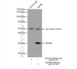 TAF9B Rabbit Polyclonal Antibody, Proteintech Unconjugated; 150 &mu;L:Antibodies,