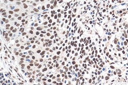 TALDO1 Mouse Monoclonal Antibody, Proteintech Unconjugated; 150 &mu;L:Antibodies,