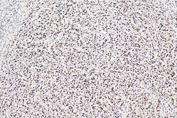 TALDO1 Mouse Monoclonal Antibody, Proteintech Unconjugated; 150 &mu;L:Antibodies,