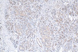 TAP1 Mouse Monoclonal Antibody, Proteintech Unconjugated; 150 &mu;L:Anticorps,