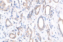 TAP1 Mouse Monoclonal Antibody, Proteintech Unconjugated; 150 &mu;L:Anticorps,