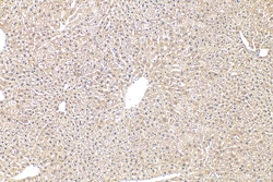 TASOR Rabbit Polyclonal Antibody, Proteintech 20 &mu;L | Buy Online | Proteintech | Fisher Scientific
