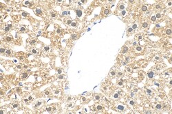 TASOR Rabbit Polyclonal Antibody, Proteintech 20 &mu;L | Buy Online | Proteintech | Fisher Scientific