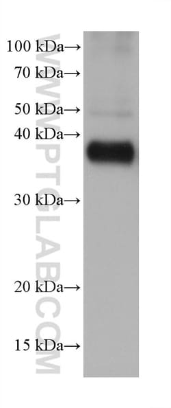TBCC Mouse Monoclonal Antibody, Proteintech Unconjugated; 20 &mu;L:Antibodies,