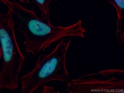 CoraLite Plus 488-conjugated TBL1X Mouse Monoclonal Antibody, Proteintech:Antibodies:Primary