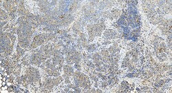 TBXAS1 Rabbit Polyclonal Antibody, Proteintech Unconjugated; 150 &mu;L:Antibodies,