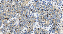 TBXAS1 Rabbit Polyclonal Antibody, Proteintech Unconjugated; 150 &mu;L:Antibodies,