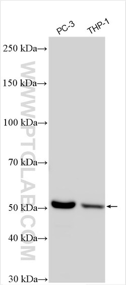 TBXAS1 Rabbit Polyclonal Antibody, Proteintech Unconjugated; 150 &mu;L:Antibodies,