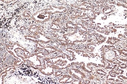 TBXAS1 Mouse Monoclonal Antibody, Proteintech:Antibodies:Primary Antibodies