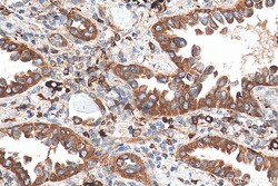 TBXAS1 Mouse Monoclonal Antibody, Proteintech:Antibodies:Primary Antibodies