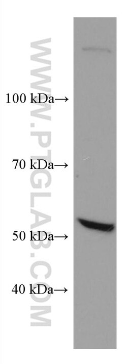 TBXAS1 Mouse Monoclonal Antibody, Proteintech:Antibodies:Primary Antibodies