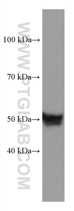 TBXAS1 Mouse Monoclonal Antibody, Proteintech:Antibodies:Primary Antibodies