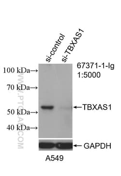 TBXAS1 Mouse Monoclonal Antibody, Proteintech:Antibodies:Primary Antibodies