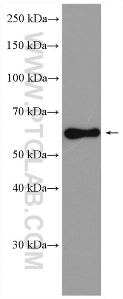 TCFL5 Rabbit Polyclonal Antibody, Proteintech Unconjugated; 150 &mu;L:Antibodies,