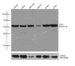 TCP1 Mouse Monoclonal Antibody, Proteintech:Antibodies:Primary Antibodies