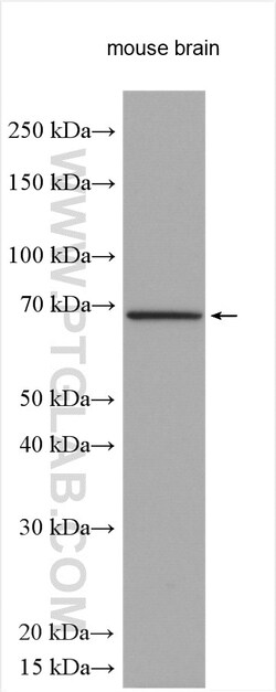 TCTN1 Rabbit Polyclonal Antibody, Proteintech Unconjugated; 150 &mu;L:Antibodies,