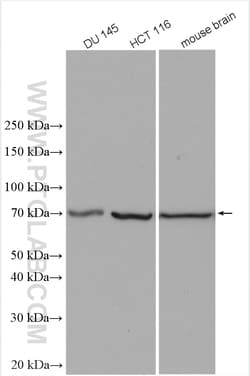 TCTN1 Rabbit Polyclonal Antibody, Proteintech Unconjugated; 150 &mu;L:Antibodies,