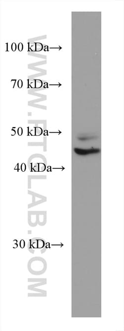 TERF1 Mouse Monoclonal Antibody, Proteintech Unconjugated; 20 &mu;L:Antibodies,