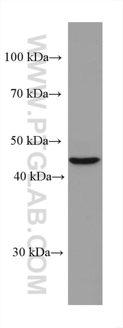 TERF1 Mouse Monoclonal Antibody, Proteintech Unconjugated; 20 &mu;L:Antibodies,