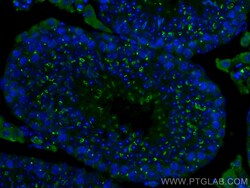 TEX14 Mouse Monoclonal Antibody, Proteintech:Antistoffer:Primære antistoffer
