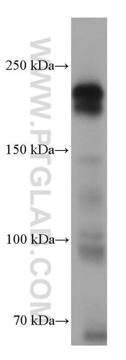 TEX14 Mouse Monoclonal Antibody, Proteintech:Antistoffer:Primære antistoffer