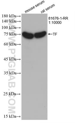 Transferrin/TF Rabbit Recombinant Antibody, Proteintech:Antibodies:Primary