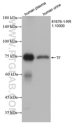 Transferrin/TF Rabbit Recombinant Antibody, Proteintech:Antibodies:Primary