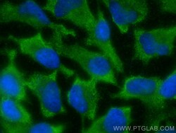 TGFB2/TGF-beta 2 Rabbit Polyclonal Antibody, Proteintech Unconjugated;